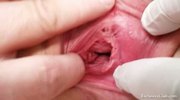 Blond female real gyno check up