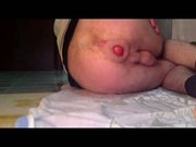 extreme anal ass