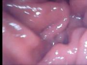 Inside view of my anal pussy