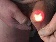 Four foreskin videos - 2 of 2