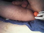 anal1