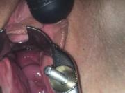 Speculum and cervix play