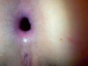 Open Anus