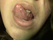 Anal