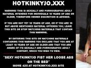 Sexy Hotkinkyjo fisting her loose prolapse ass on the bed