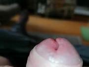 Precum n smegma