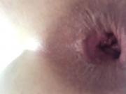 Anal Gape
