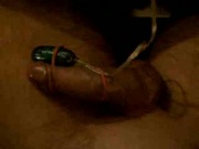 Electro Cock Stimulation