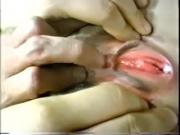 Clitoris