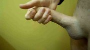 foreskin
