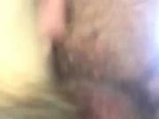 Anal