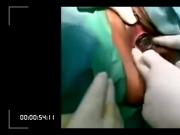 Performing Vagina Operation.
