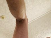 mynatdick