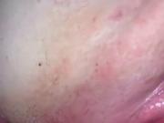 penetrarion