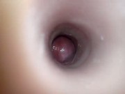 Inside the anus