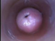 Vaginal uterus and intravaginal ejaculation307