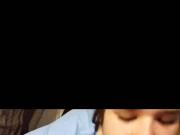 Girls receives massive facial