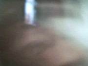 foreskin 3