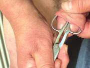 Foreskin with scissors