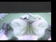 Hidden Cam In Solarium