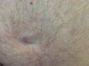 Removing rings