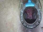 horny anus speculum closeup 720p