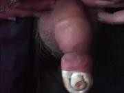 Mushrooms foreskin