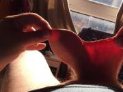 Foreskin in sunlight with plastic lid