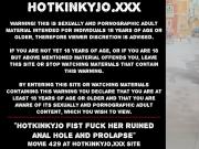 Hotkinkyjo fist fuck her ruined anal hole and prolapse