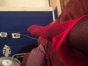 short leg cast fun 2