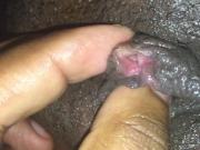 Camel toe