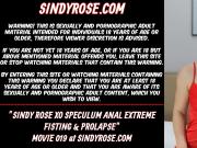 Sindy Rose XO speculum anal extreme fisting & prolapse