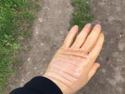 Wearing transparent latex gloves outdoor