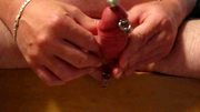 komme mit 10mm Dilator