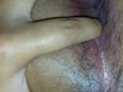 my anus 2