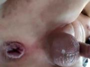 Gape