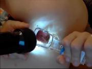 Russian girl in webcam with anal speculum