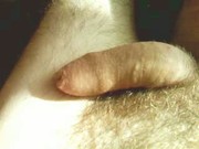 Erection
