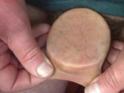 Foreskin with 3 dice and a plastic lid