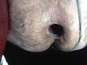 encuentro anal