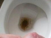 Piss