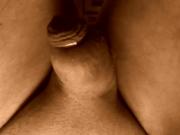 Prepuce
