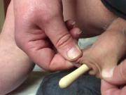 Rattle toy in foreskin