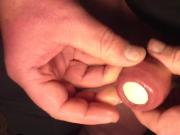 Foreskin with table tennis ball