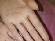 nail