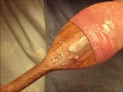 Another three videos - foreskin with spoon