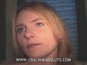 Crackhead whore talks about her sad life