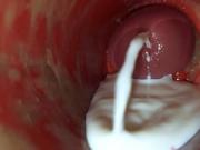 Camera Inside Deep Pussy Captures Huge Ejaculation of Sperm ASMR