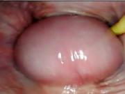 AMAZING INTERNAL POV. CAMERA INSIDE HER PUSSY WHILE I FILL HER WITH CUM