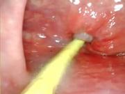 EXTREME ANAL POV. CAMERA INSIDE HER ASSHOLE AS I POUND HER WITH MY BIG COCK AND CUM DEEP INSIDE
